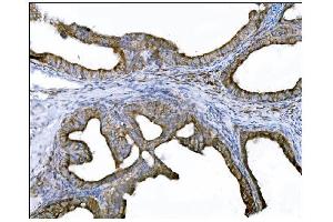 IHC analysis of DLGAP1 using anti-DLGAP1 antibody (ABIN7600257). (DLGAP1 anticorps  (AA 17-319))