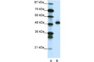 WB Suggested Anti-MEOX2 Antibody Titration:  1. (MEOX2 anticorps  (C-Term))