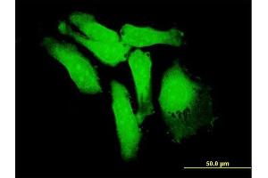 Immunofluorescence of purified MaxPab antibody to S100P on HeLa cell.
