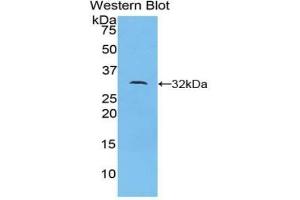 Western blot analysis of the recombinant protein. (DOCK1 anticorps  (AA 1200-1435))