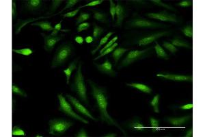 Immunofluorescence of monoclonal antibody to HGD on HeLa cell. (HGD anticorps  (AA 377-445))