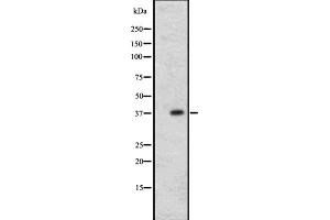 Western blot analysis of CCR1 expression in A431 whole cell lysate ,The lane on the left is treated with the antigen-specific peptide.