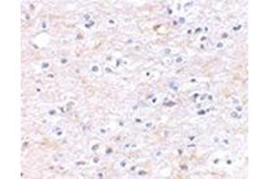 Immunohistochemical staining of human brain tissue using AP30926PU-N at 2.