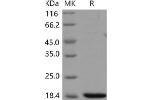 Western Blotting (WB) image for Regenerating Islet-Derived 3 beta (REG3B) protein (His tag) (ABIN7320032) (REG3B Protein (His tag))