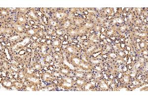 Detection of HK1 in Rat Kidney Tissue using Polyclonal Antibody to Hexokinase 1 (HK1)