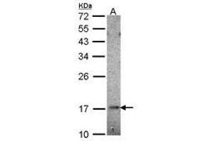 Image no. 2 for anti-Ubiquitin-Conjugating Enzyme E2B (UBE2B) (AA 7-152) antibody (ABIN467405)
