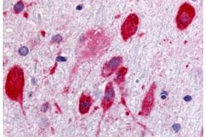 Immunohistochemistry (Formalin/PFA-fixed paraffin-embedded sections) of rat brain, neurons with GPR171 polyclonal antibody . (GPR171 anticorps  (3rd Cytoplasmic Domain))
