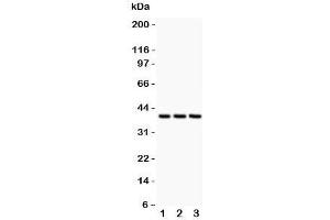 Western blot testing of CXCR6 antibody and  Lane 1: HeLa;  2: Jurkat;  3: MCF-7 lysate.