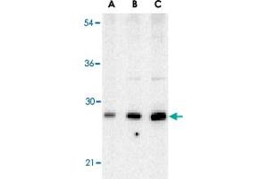 Western blot analysis of BCAP29 in human heart tissue lysate with BCAP29 polyclonal antibody  at (A) 0. (BCAP29 anticorps  (Internal Region))