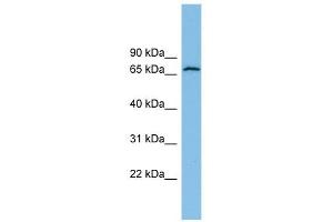 GLUD2 antibody used at 1 ug/ml to detect target protein.