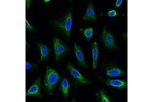 Immunofluorescent analysis of Aquaporin 4 staining in Hela cells. (Aquaporin 4 anticorps)