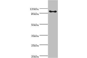 Western blot All lanes: AP-2 complex subunit beta antibody at 8 μg/mL + Mouse brain tissue Secondary Goat polyclonal to rabbit IgG at 1/10000 dilution Predicted band size: 105, 106, 99 kDa Observed band size: 105 kDa