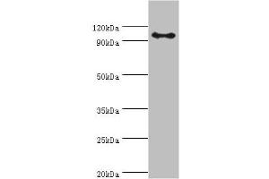 Western blot All lanes: AP-2 complex subunit beta antibody at 8 μg/mL + Mouse brain tissue Secondary Goat polyclonal to rabbit IgG at 1/10000 dilution Predicted band size: 105, 106, 99 kDa Observed band size: 105 kDa (AP2B1 anticorps  (AA 738-937))