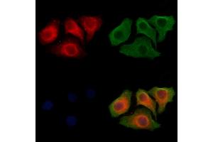 ABIN6264415 and ABIN6278511 staining Hela cells by IF/ICC. (SLC26A5 anticorps  (Internal Region))