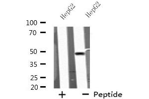 Western blot analysis of extracts from HepG2 cells, using KCNN4 antibody. (KCNN4 anticorps  (C-Term))
