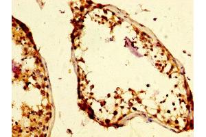 IHC image of ABIN7145750 diluted at 1:500 and staining in paraffin-embedded human testis tissue performed on a Leica BondTM system.