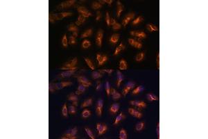 Immunofluorescence analysis of U-2 OS cells using Somatostatin Receptor 2 (SSTR2) Polyclonal Antibody (ABIN7270493) at dilution of 1:100 (40x lens).