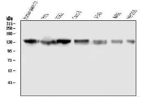 Western blot analysis of GM130 using anti-GM130 antibody (ABIN6719433).