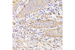 Immunohistochemistry of paraffin-embedded human appendix using PSMG1 antibody (ABIN7269593) at dilution of 1:100 (40x lens). (PSMG1 anticorps  (AA 1-288))