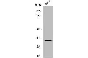 Western Blot analysis of HuvEc cells using DIO3 Polyclonal Antibody (DIO3 anticorps  (Internal Region))