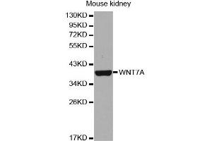 Western Blotting (WB) image for anti-Wingless-Type MMTV Integration Site Family, Member 7A (WNT7A) antibody (ABIN1876613) (WNT7A anticorps)