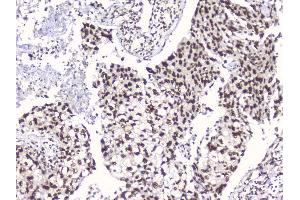 IHC analysis of RbAp48 using anti-RbAp48 antibody (ABIN5692929). (Retinoblastoma Binding Protein 4 anticorps  (C-Term))