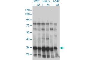 Western Blotting (WB) image for anti-High Mobility Group 20B (HMG20B) (AA 1-110) antibody (ABIN599130) (HMG20B anticorps  (AA 1-110))