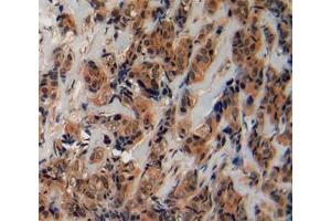 Used in DAB staining on fromalin fixed paraffin- embedded breast cancer tissue (Fibrillin 2 anticorps  (AA 1550-1791))