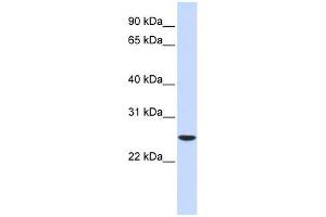 UBE2K antibody used at 0. (UBE2K anticorps  (Middle Region))