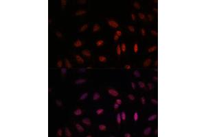 Immunofluorescence analysis of U-2 OS cells using WDR18 antibody (ABIN7271354) at dilution of 1:100.