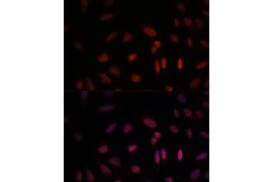 Immunofluorescence analysis of U-2 OS cells using WDR18 antibody (ABIN7271354) at dilution of 1:100. (WDR18 anticorps  (AA 243-432))
