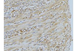 ABIN6275351 at 1/100 staining Mouse muscle tissue by IHC-P. (PEX7 anticorps  (C-Term))