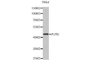Western Blotting (WB) image for anti-Fucosyltransferase 6 (Alpha (1,3) Fucosyltransferase) (FUT6) antibody (ABIN1872749) (FUT6 anticorps)