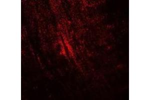 Immunofluorescence of MYBPC1 in mouse skeletal muscle cells with MYBPC1 antibody at 20 ug/mL.