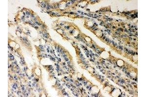 IHC-P: Rad51 antibody testing of rat intestine tissue