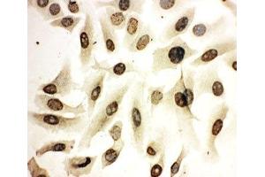 ICC testing of HeLa cells (HOXA4 anticorps  (N-Term))