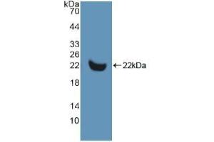 Western blot analysis of recombinant Human MMP13. (MMP13 anticorps  (AA 290-468))