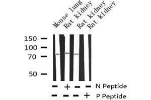 Western blot analysis of Phospho-SYK (Tyr348) expression in various lysates