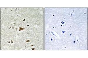 Immunohistochemistry analysis of paraffin-embedded human brain tissue, using Smad2 (Ab-220) Antibody. (SMAD2 anticorps  (AA 186-235))