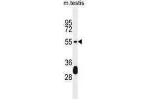 KT33A Antibody (N-term) western blot analysis in mouse testis tissue lysates (35µg/lane). (Keratin 33A anticorps  (N-Term))
