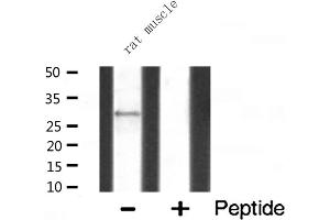 Western blot analysis of MRPL10 expression in Rat muscle lysate