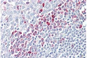 Anti-PARP6 antibody IHC staining of human tonsil. (PARP6 anticorps  (AA 431-480))
