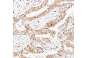 Immunohistochemistry (IHC) image for anti-UBA Domain Containing 1 (UBAC1) (AA 325-375) antibody (ABIN7455006)