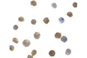 Immunocytochemistry of IRAK2 in A-20 cells with AP30439PU-N IRAK2 antibody at 1 μg/ml.