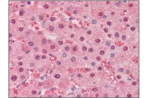 Immunohistochemistry (IHC) image for anti-Fatty Acid Binding Protein 1, Liver (FABP1) (AA 1-127), (N-Term) antibody (ABIN317518)