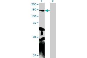 Western Blot analysis of MYLK expression in transfected 293T cell line by MYLK MaxPab polyclonal antibody. (MYLK anticorps  (AA 1-992))