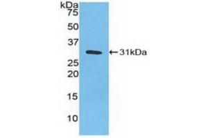 Western blot analysis of recombinant Human CA3. (CA3 anticorps  (AA 2-260))