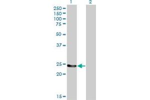 Western Blot analysis of GSTM4 expression in transfected 293T cell line by GSTM4 monoclonal antibody (M01), clone 4B4. (GSTM4 anticorps  (AA 23-119))