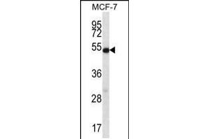 Western blot analysis in MCF-7 cell line lysates (35ug/lane). (Coilin anticorps  (AA 157-186))