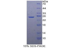 SDS-PAGE analysis of Human SDF2 Protein. (SDF2 Protéine)